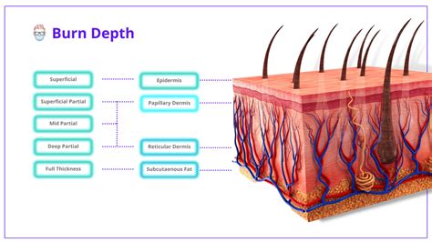 measuring burn depth thickness researchgate|Early Assessment of Burn Depth with Far Infrared Time.